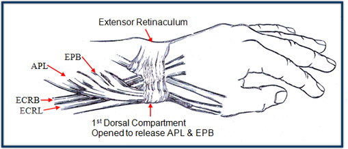 I’ve Got Pain in my Wrist, What is it? - MGS Physiotherapy